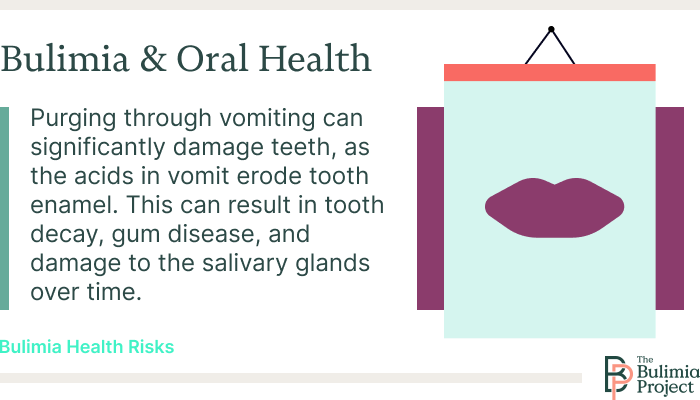 oral