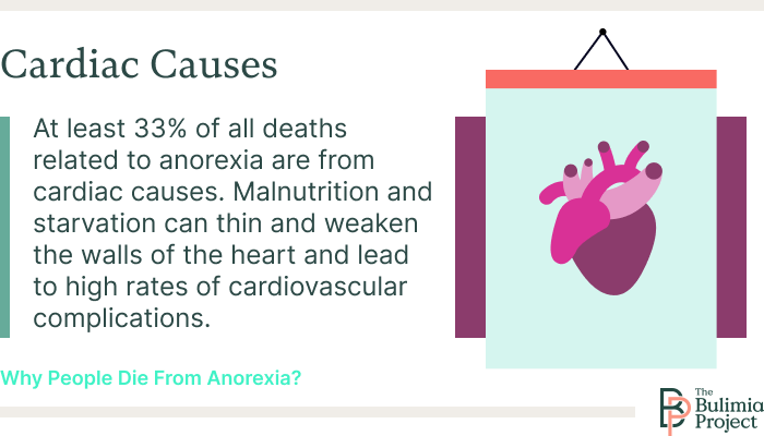 cardiac issues graphic